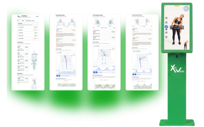 Xenco Medical Unveils XenVision, an AI-Driven Musculoskeletal Health Platform at SIGGRAPH 2026